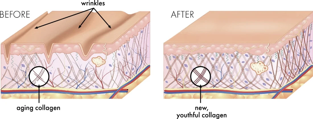 youg old skin diagram youg old skin diagram