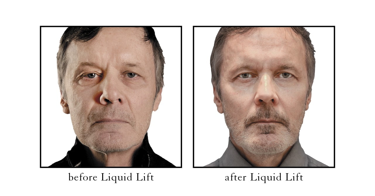 liquid lift full face