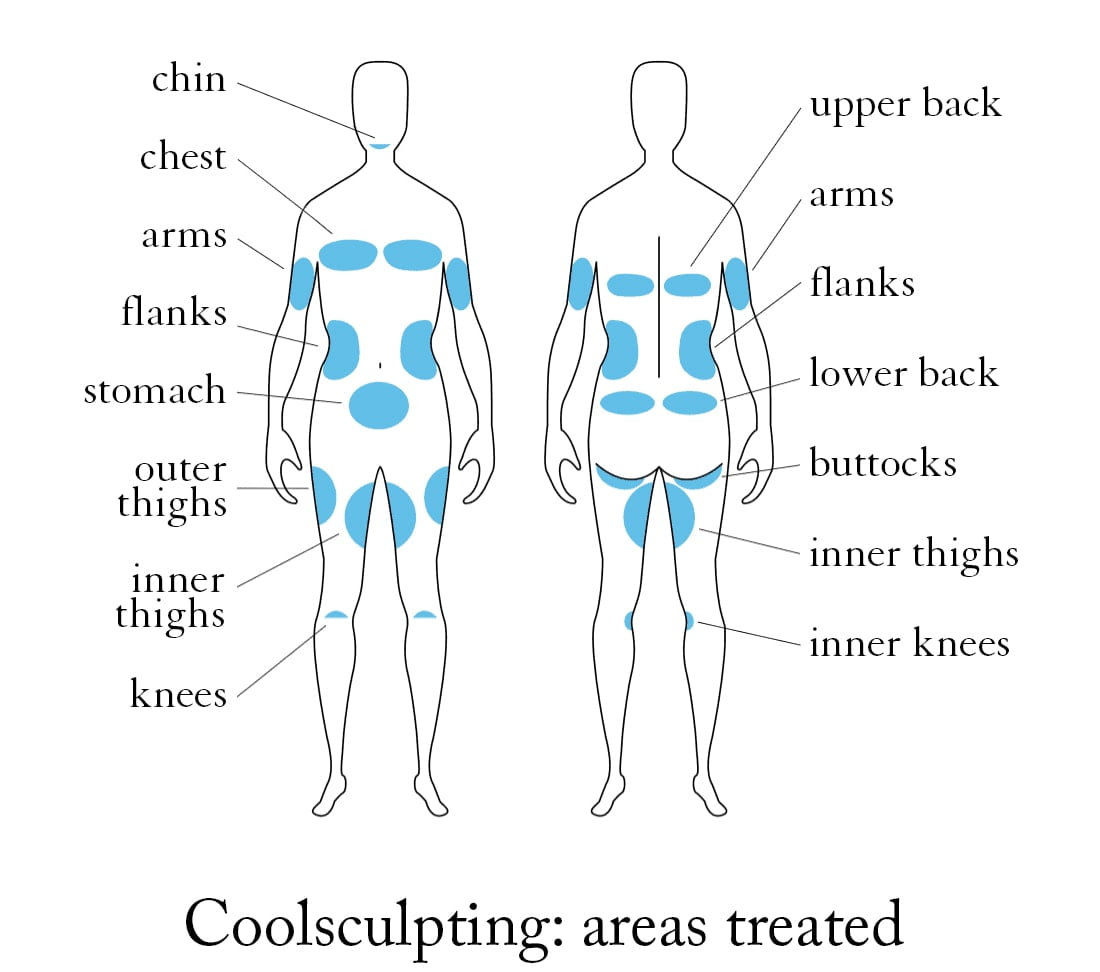 areas coolsculpting