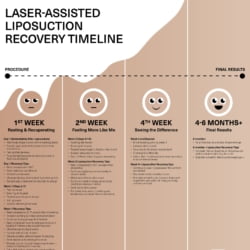 Liposuction Recovery Week by Week