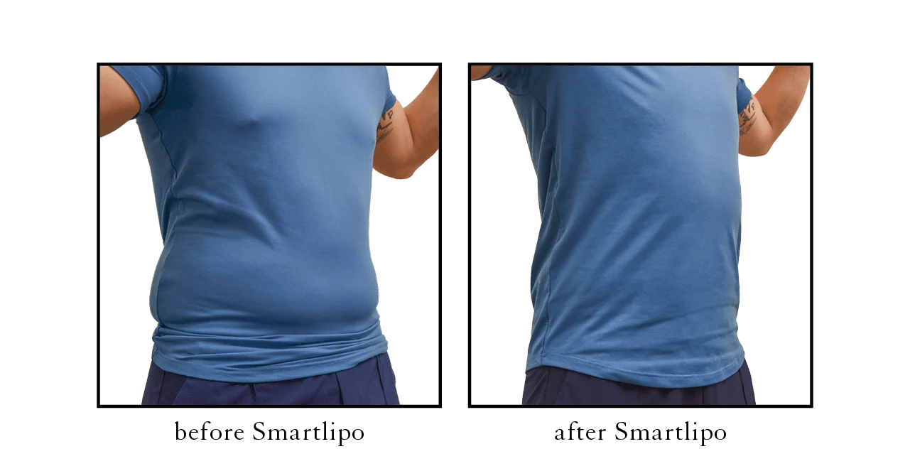 lipo70 Actual CSLC Results