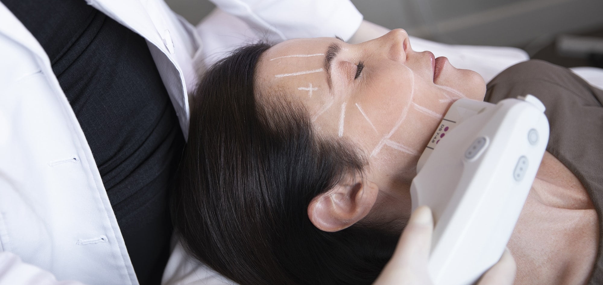 Ultherapy Laser Skin Tightening For The Face - Perfect Body Laser