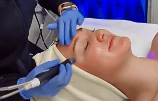 Hydrafacial