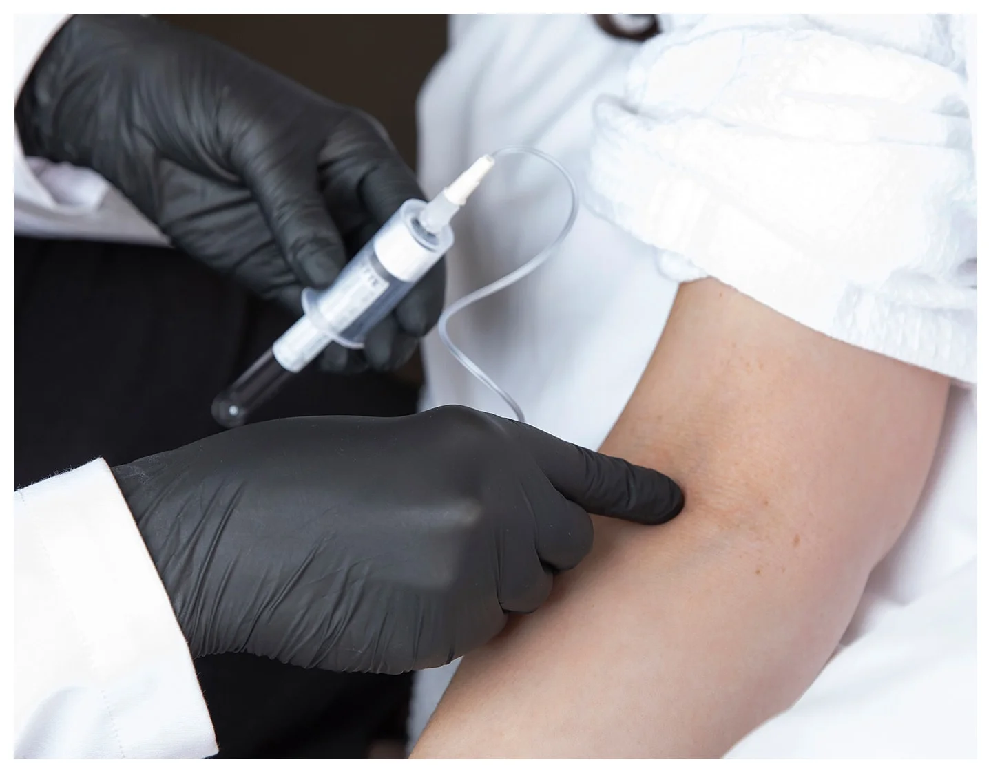 PRF injection 4 PRF injection