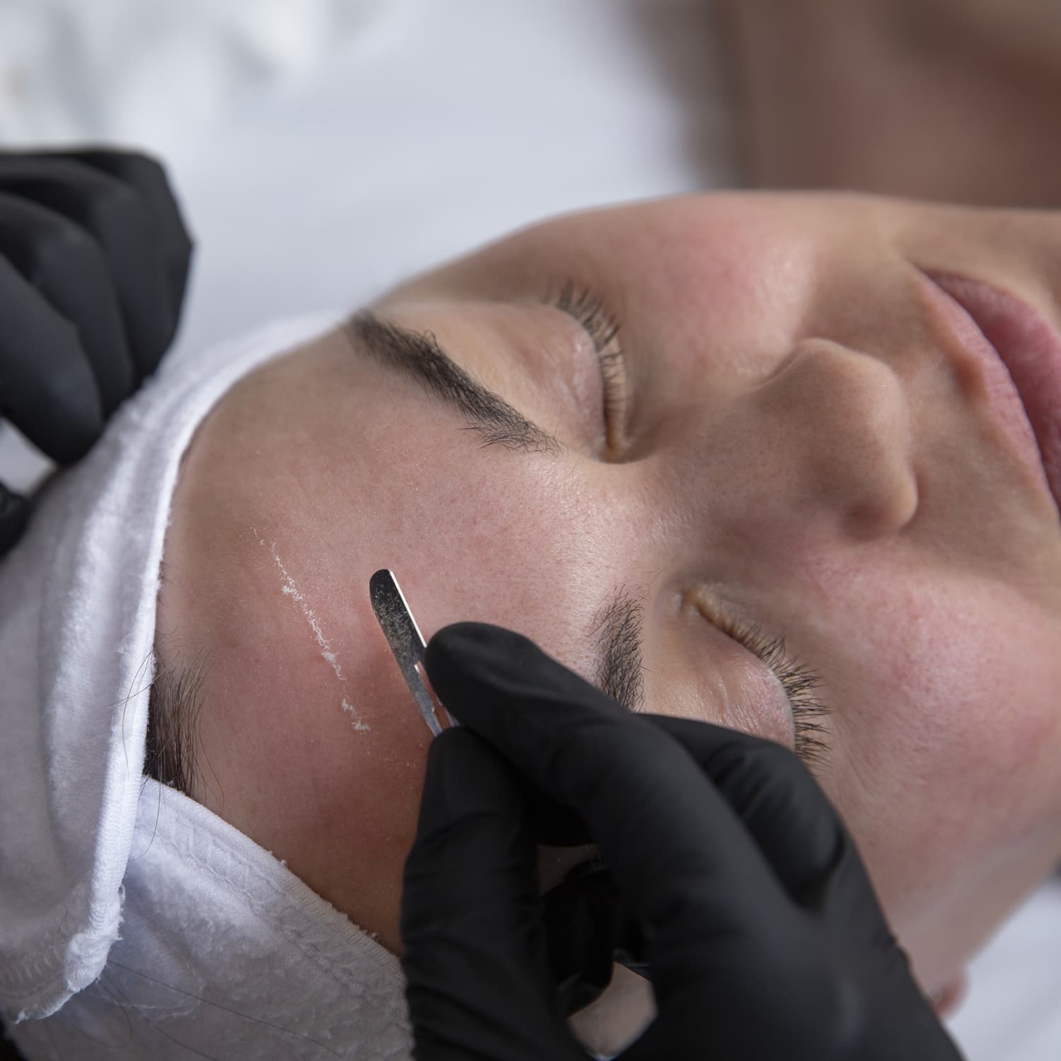 Dermaplane Facial Skin Care Cosmetic Skin And Laser Center