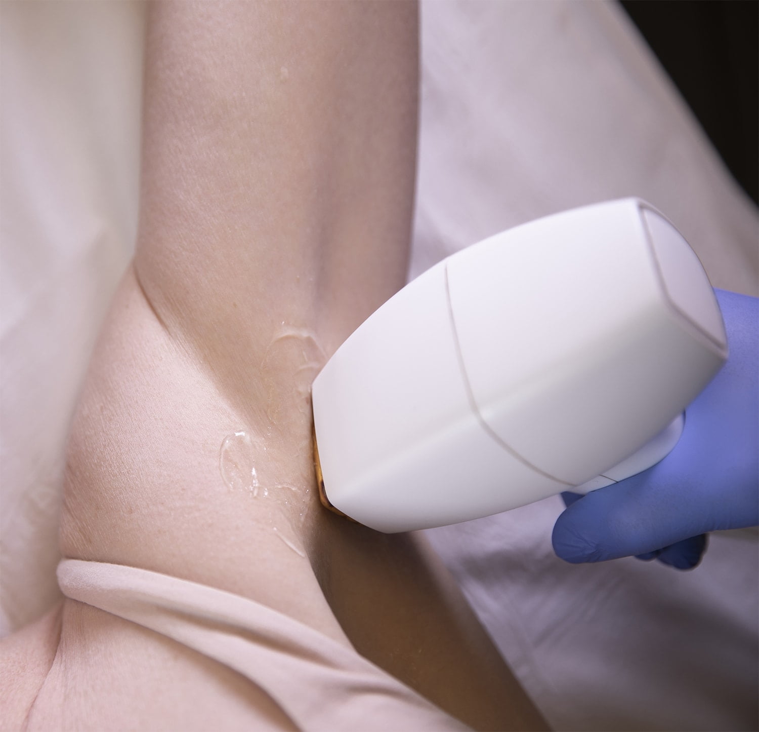 Laser Hair Removal Experts 20 years Cosmetic Skin Laser Center