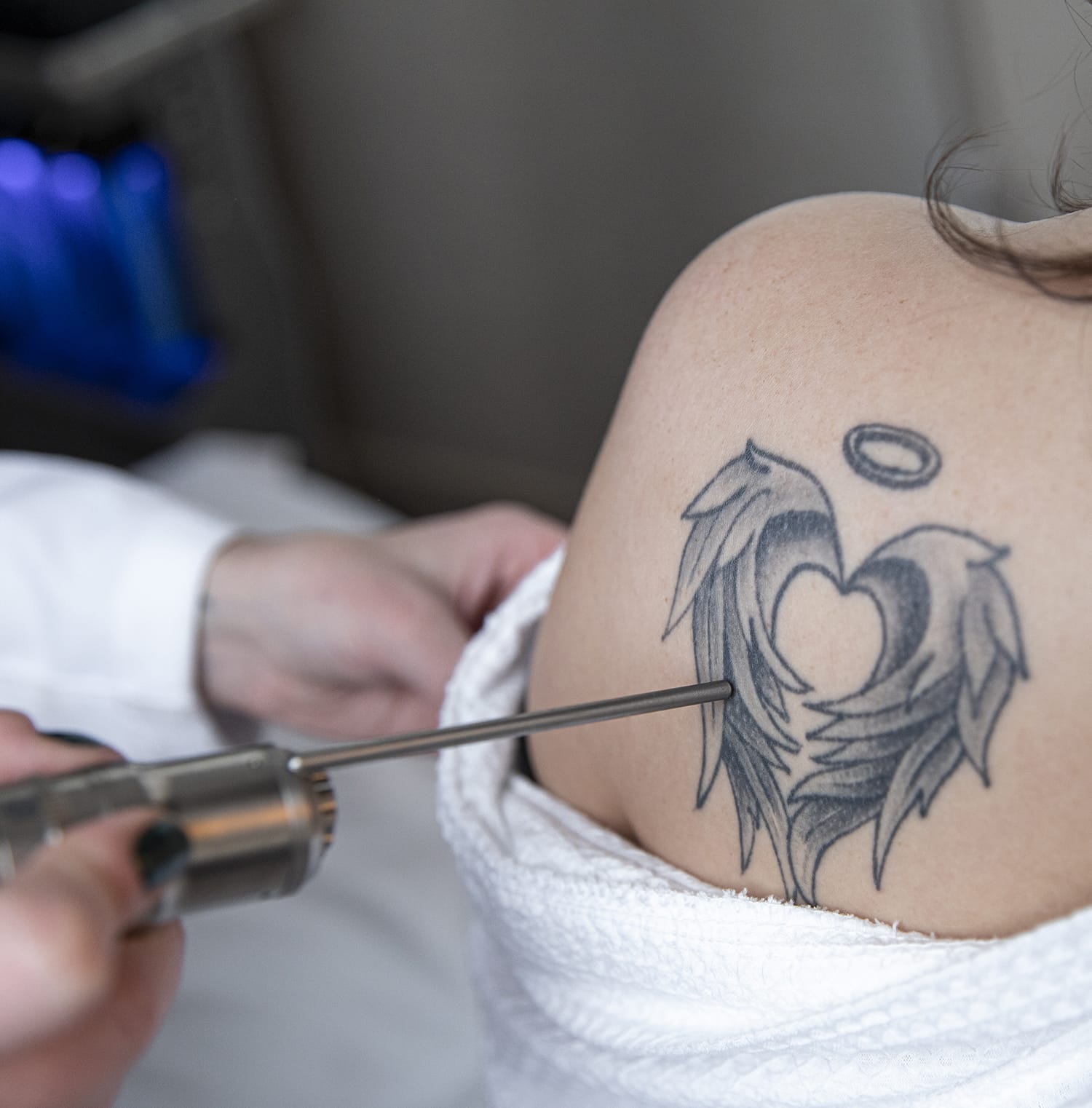 Traverse City Tattoo Removal  Cosmetic Skin  Laser Center