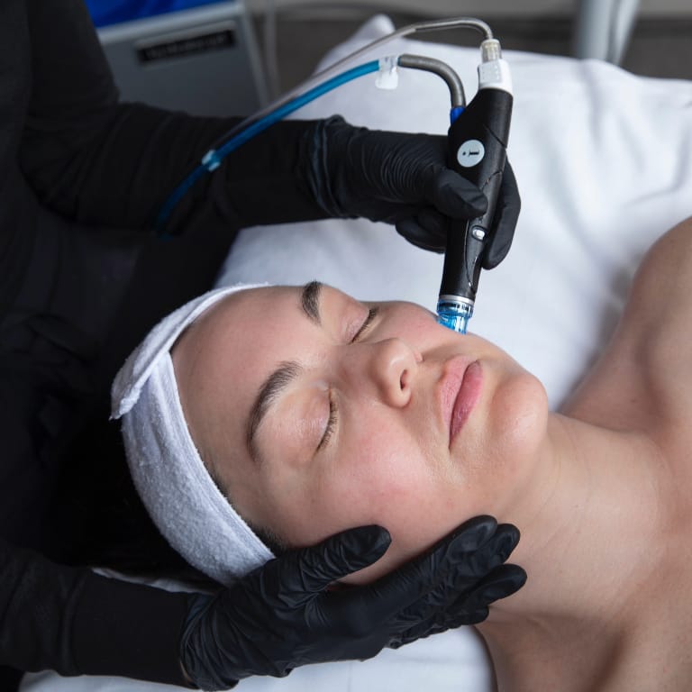 Hydrafacial treatment in Winter Park at Cosmetic Skin & Laser Center