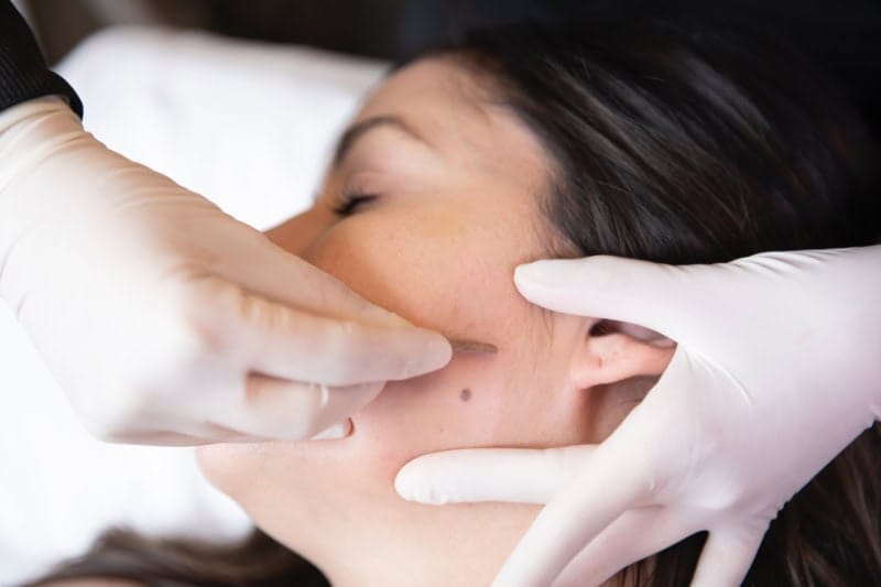 Dermaplaning skin treatment at CSLC in Northern Michigan